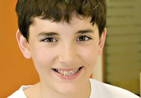 Ortodoncia niños Palma Mallorca. Clínica COped Ortodoncia niños Palma Mallorca. Clínica COped
