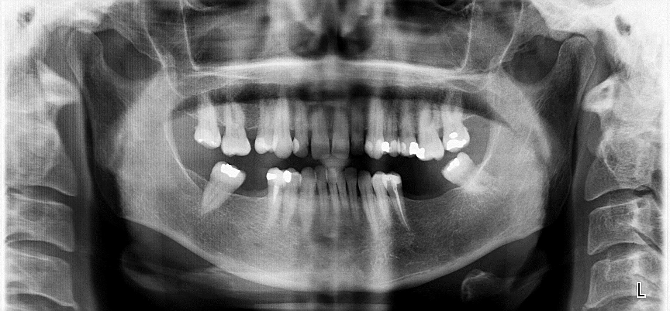 radiografia frente