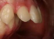 dientes