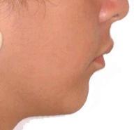 mandibula
