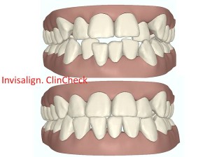 Diapositiva1