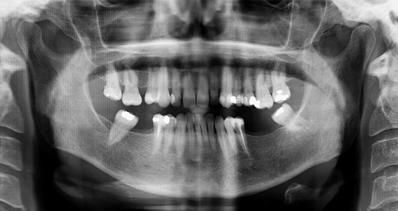 radiografia frente